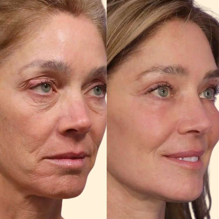 Collagen Night Wrapping Mask 18 53